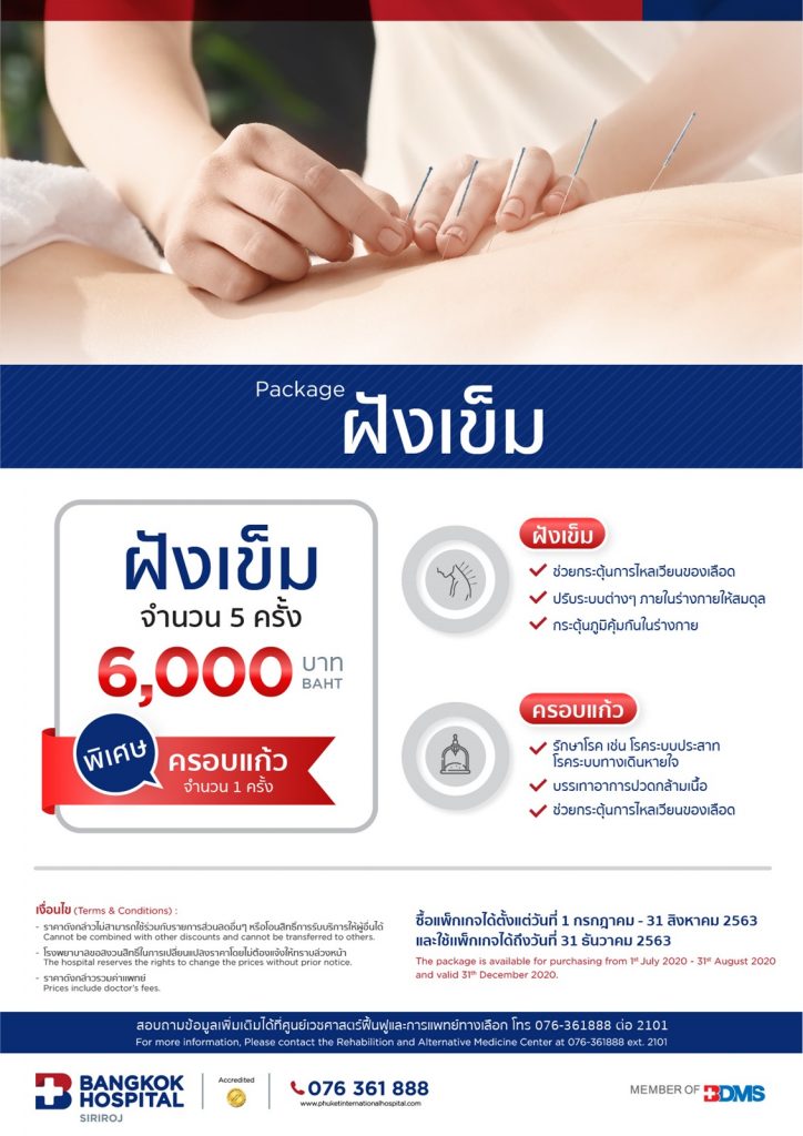 เเพ็กเกจฝังเข็ม